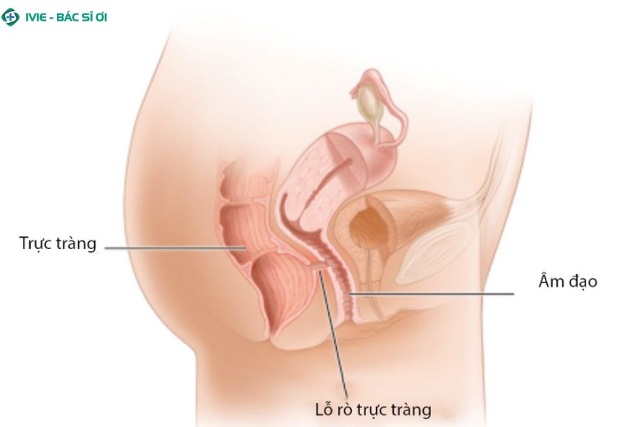 Cấu tạo trực tràng mỏng và không tự bôi trơn khiến quan hệ hậu môn tiềm ẩn nhiều rủi ro tổn thương niêm mạc