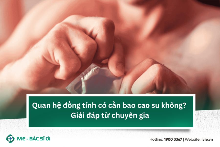 Quan hệ đồng tính có cần bao cao su không? Giải đáp từ...